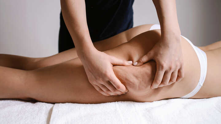 woman having a massge to treat cellulite